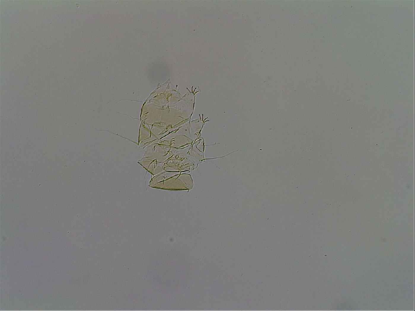 Echiniscus trisetosus image