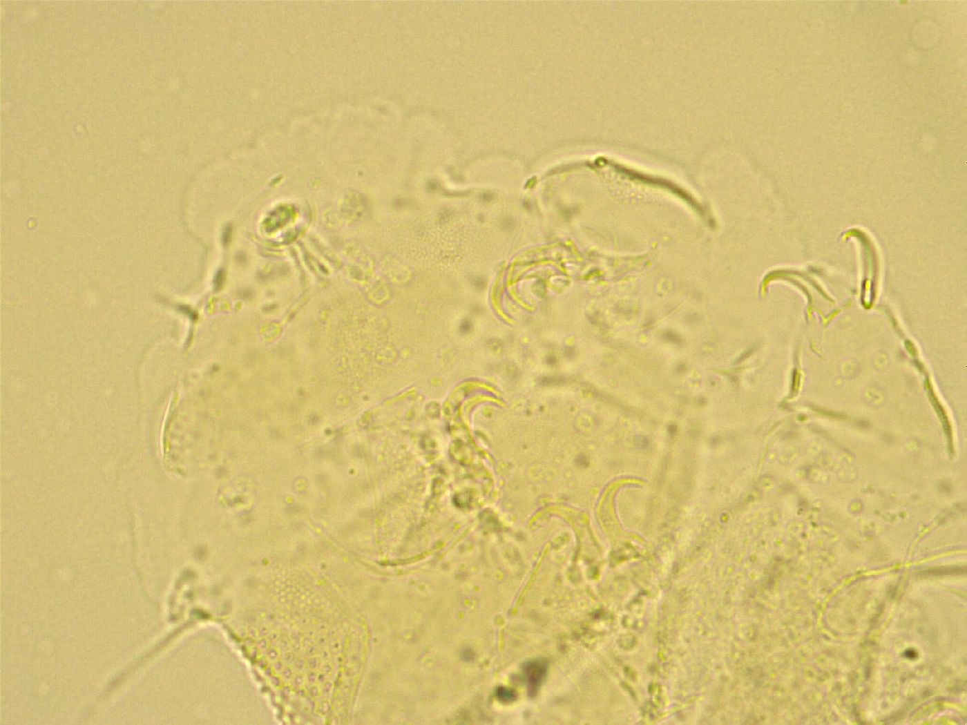 Echiniscus trisetosus image