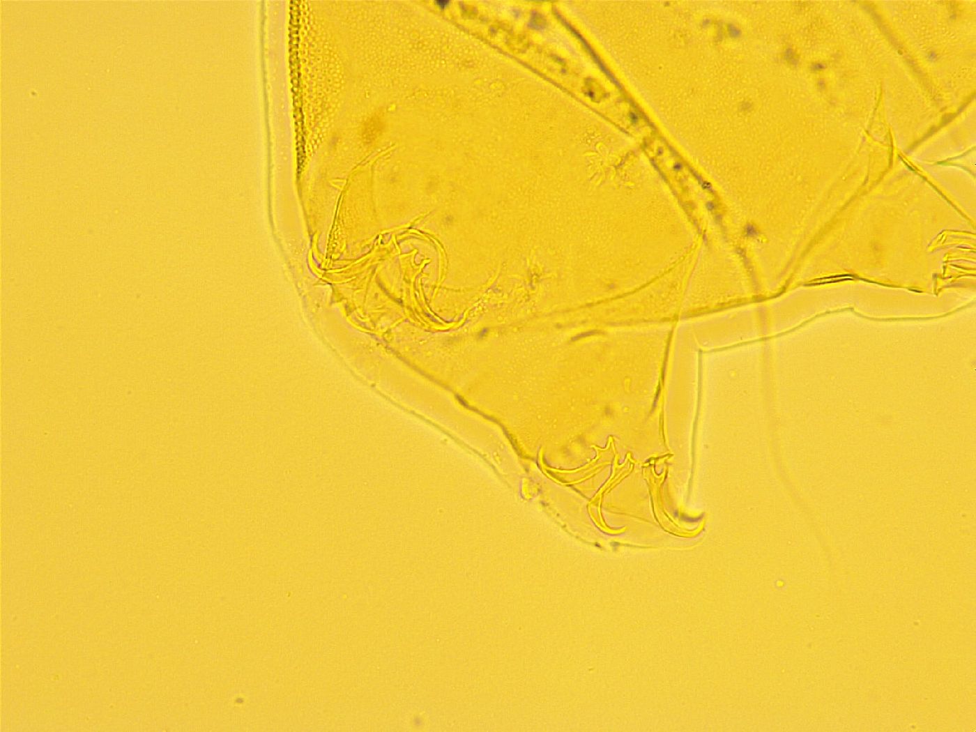 Echiniscus trisetosus image