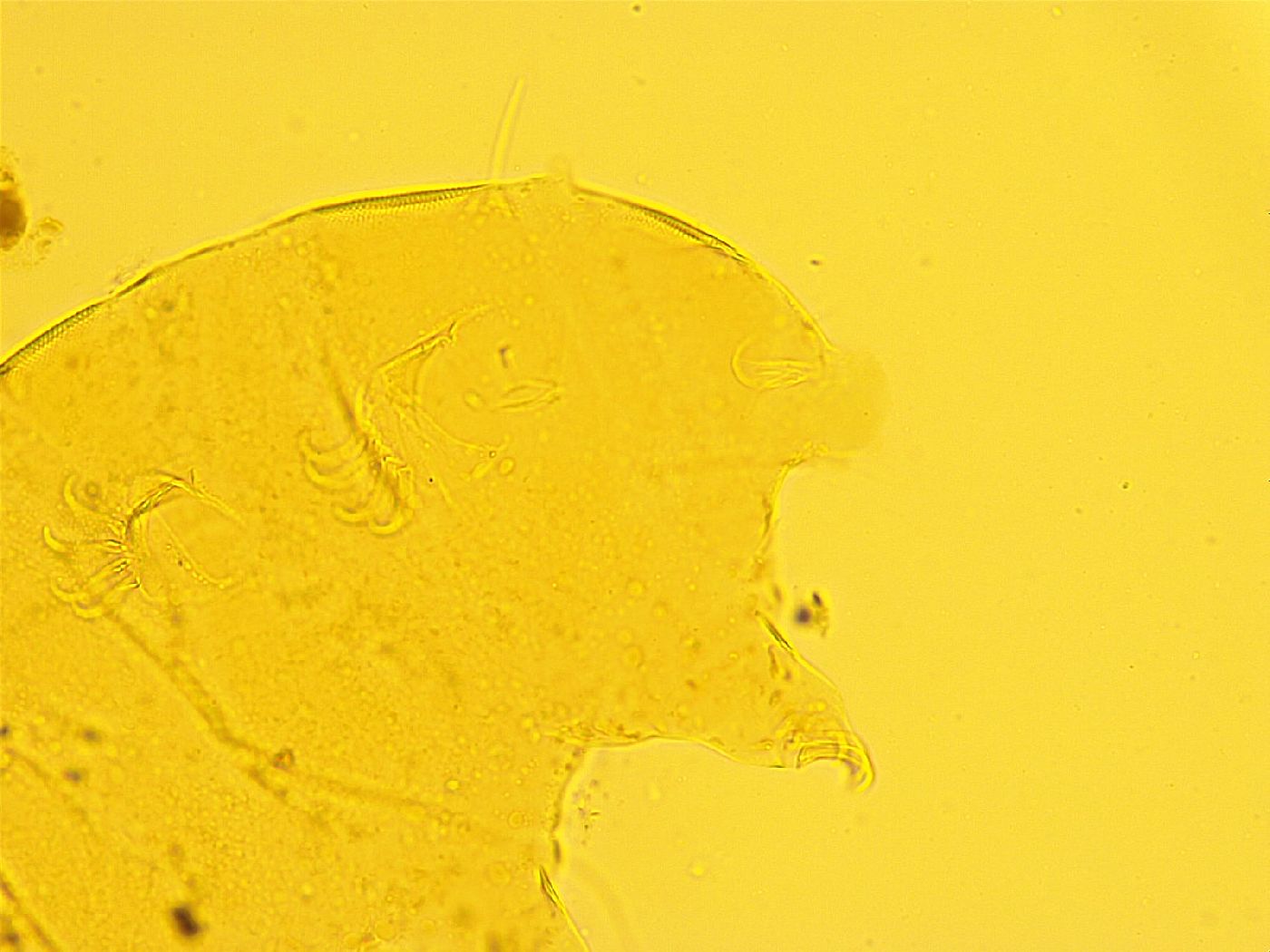 Echiniscus trisetosus image