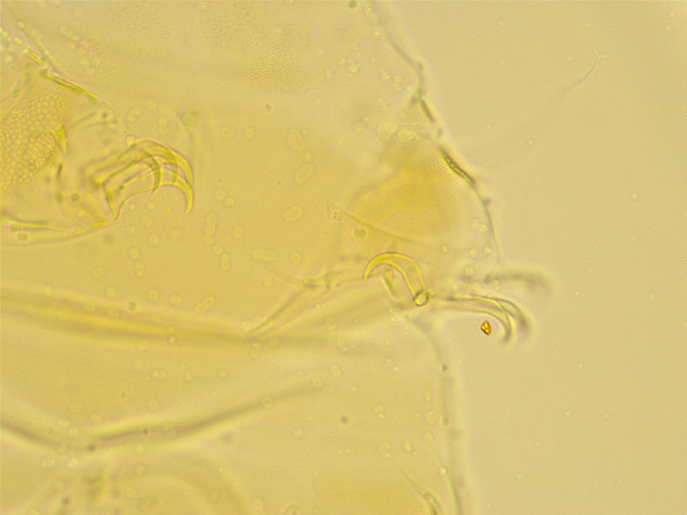 Echiniscus trisetosus image