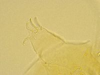 Echiniscus trisetosus image
