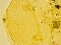 Echiniscus trisetosus image