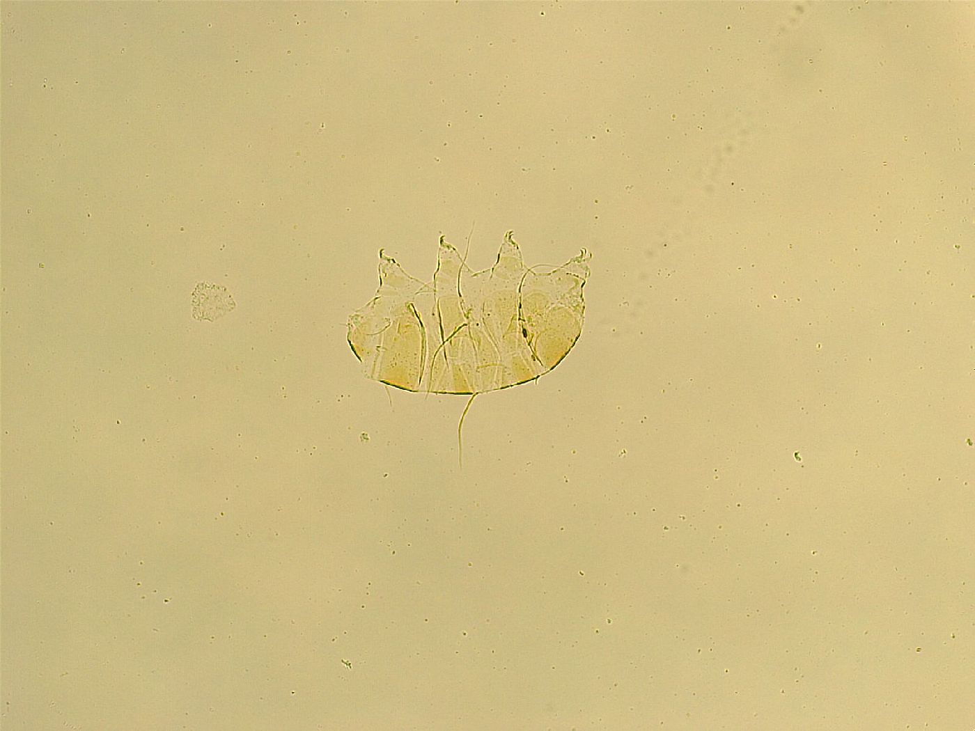 Echiniscus trisetosus image