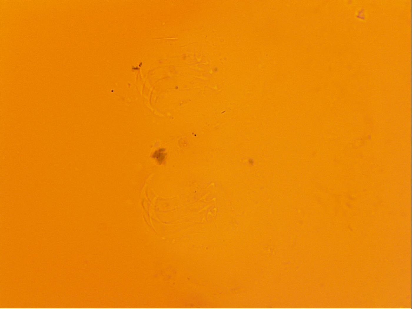 Echiniscus trisetosus image