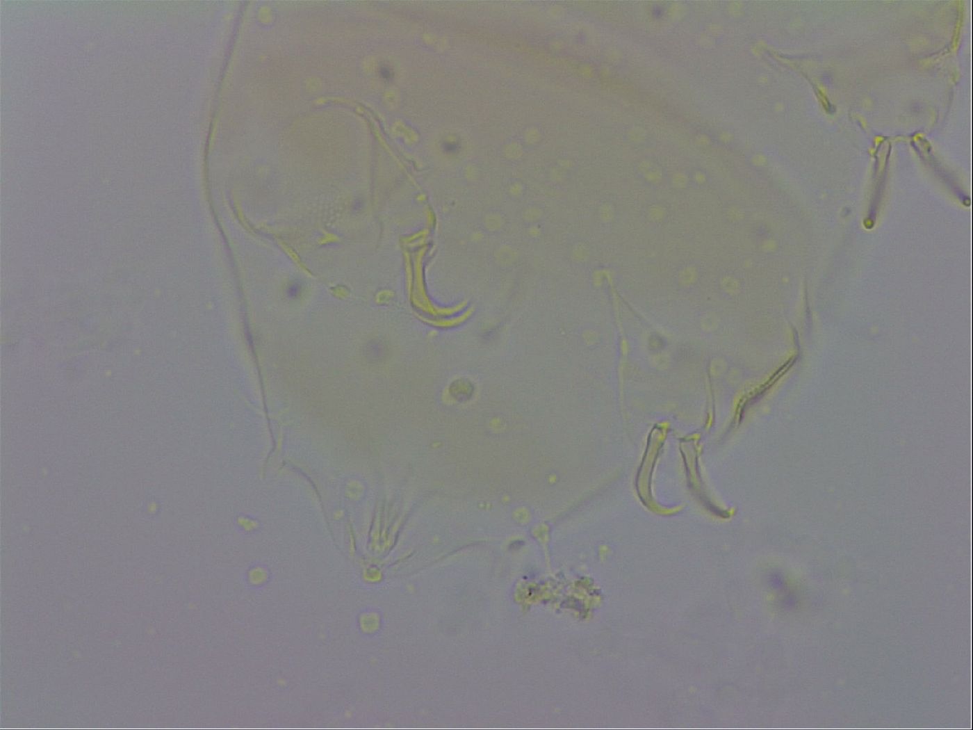 Echiniscus trisetosus image