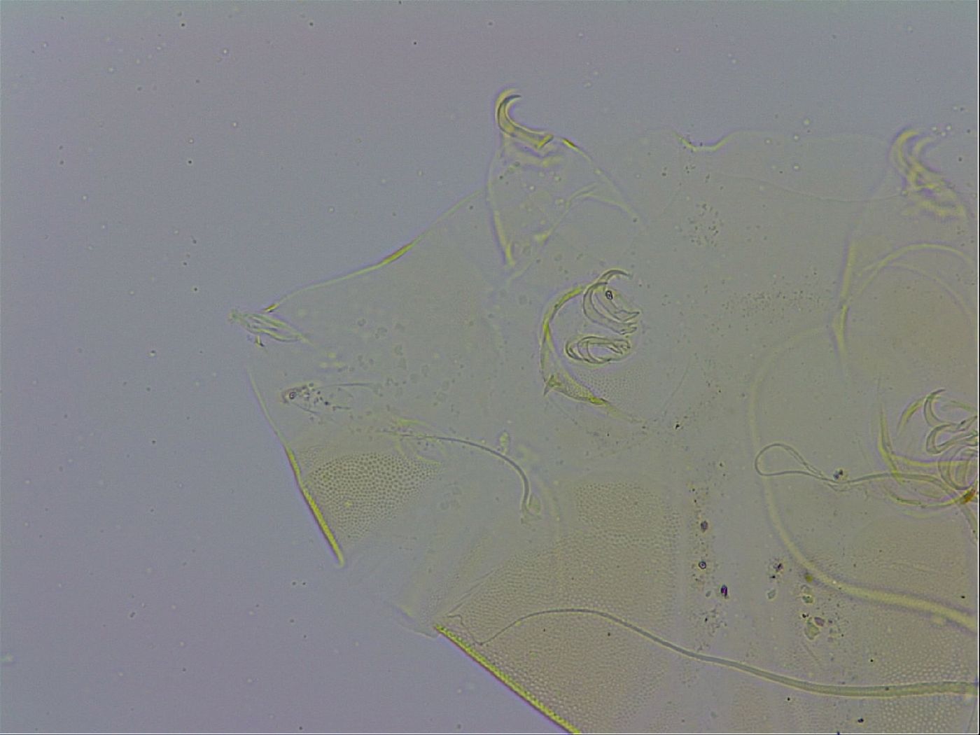 Echiniscus trisetosus image