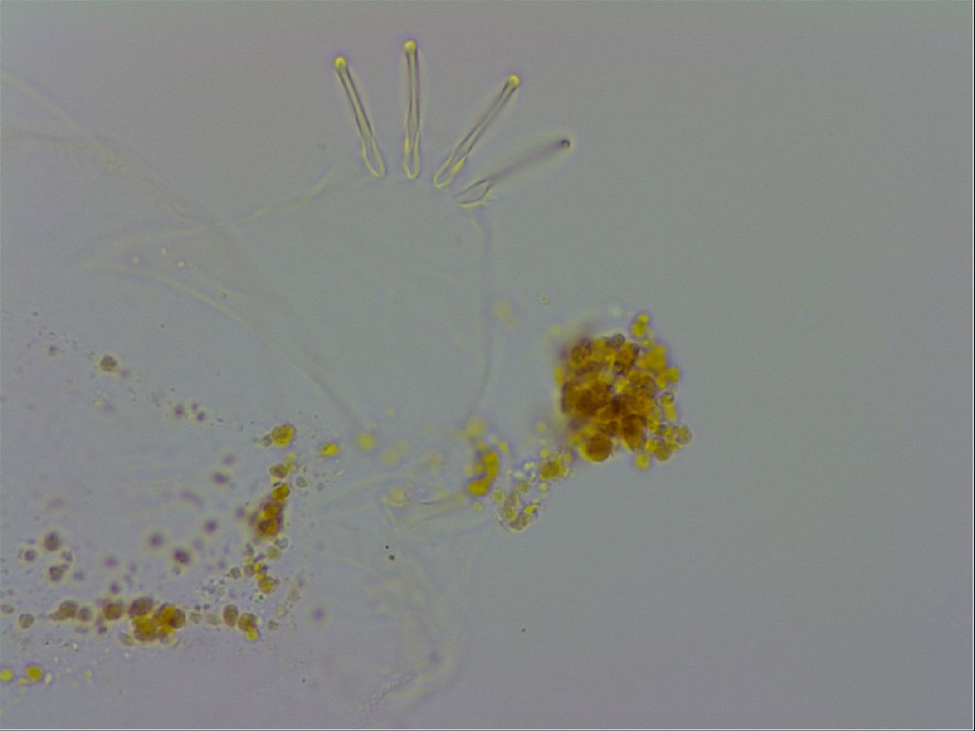 Echiniscus trisetosus image