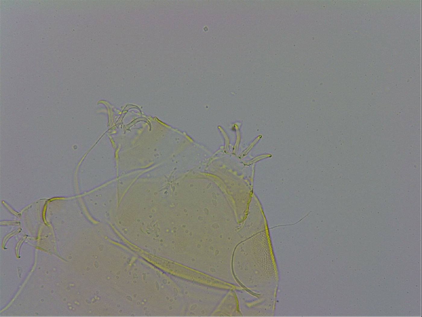 Echiniscus trisetosus image