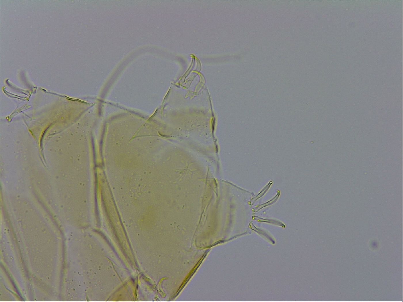 Echiniscus trisetosus image