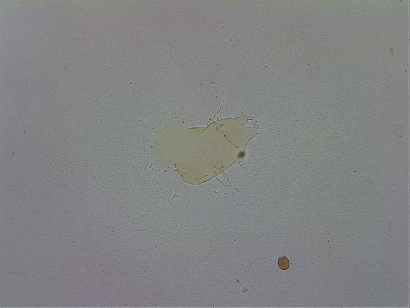 Echiniscus trisetosus image