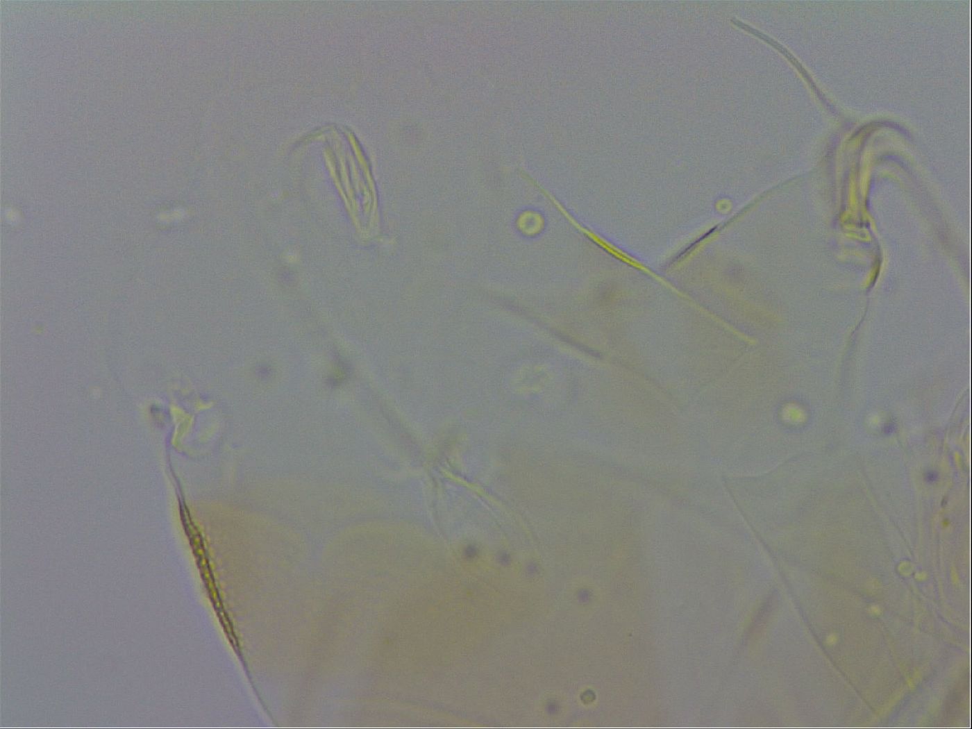 Echiniscus trisetosus image