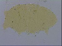 Echiniscus trisetosus image