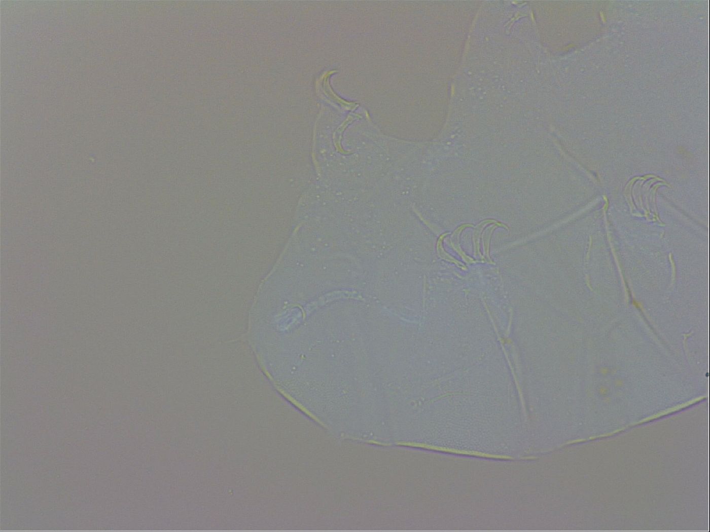 Echiniscus trisetosus image