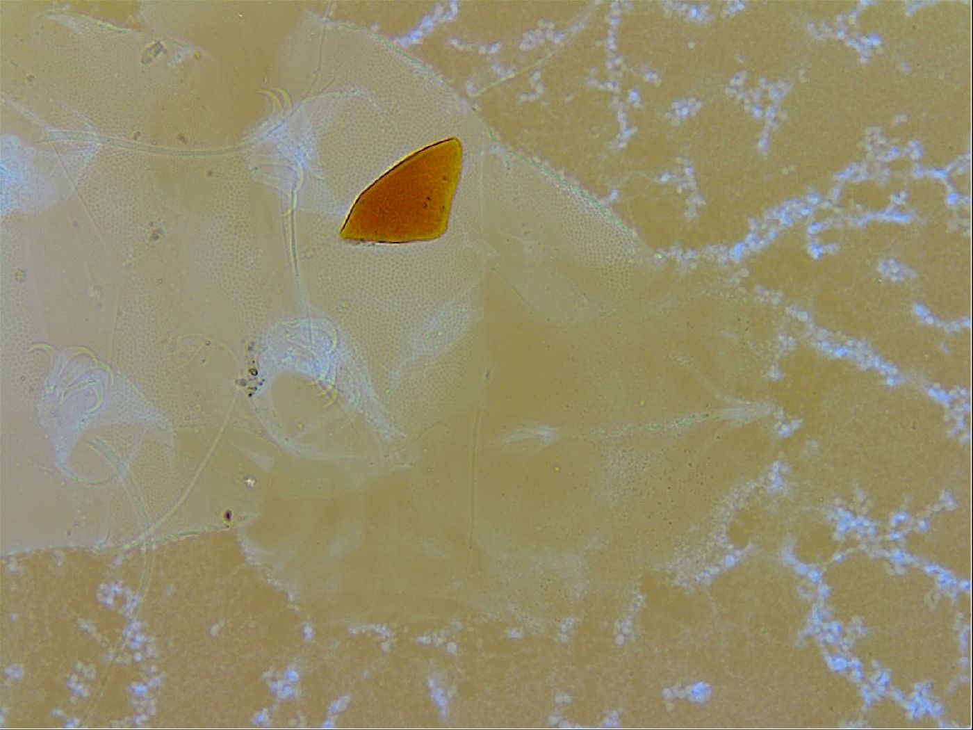 Echiniscus trisetosus image