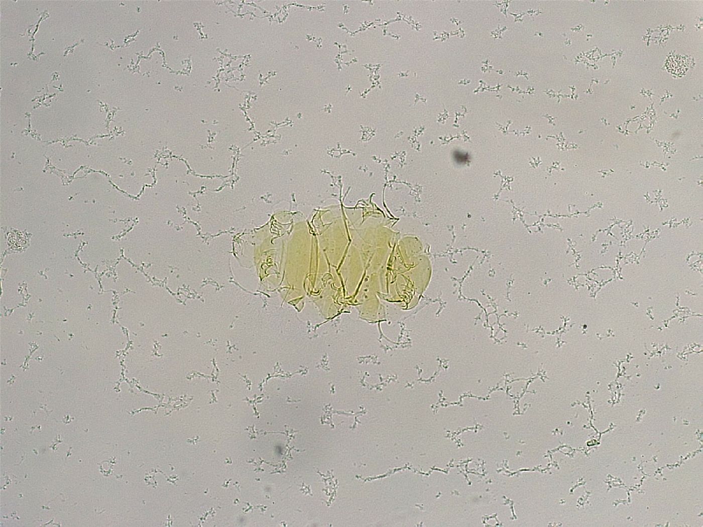 Echiniscus trisetosus image