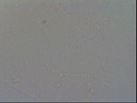 Ramazzottius oberhaeuseri image
