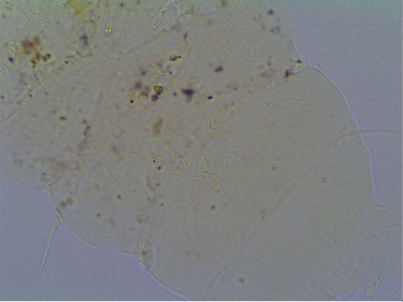 Echiniscus virginicus image