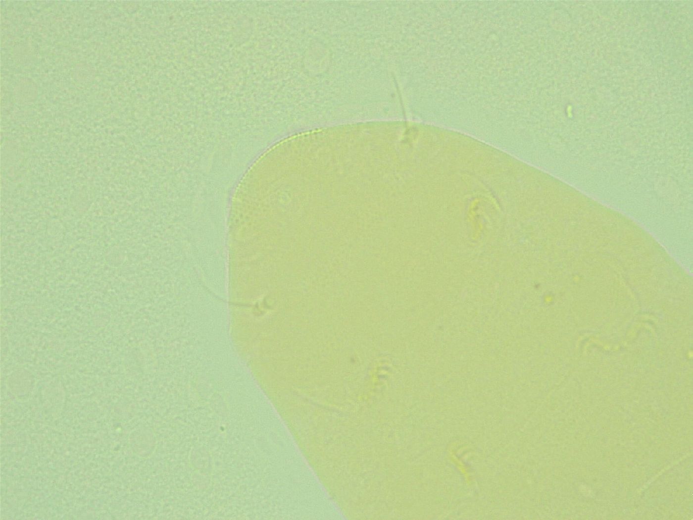 Pseudechiniscus novaezeelandiae image