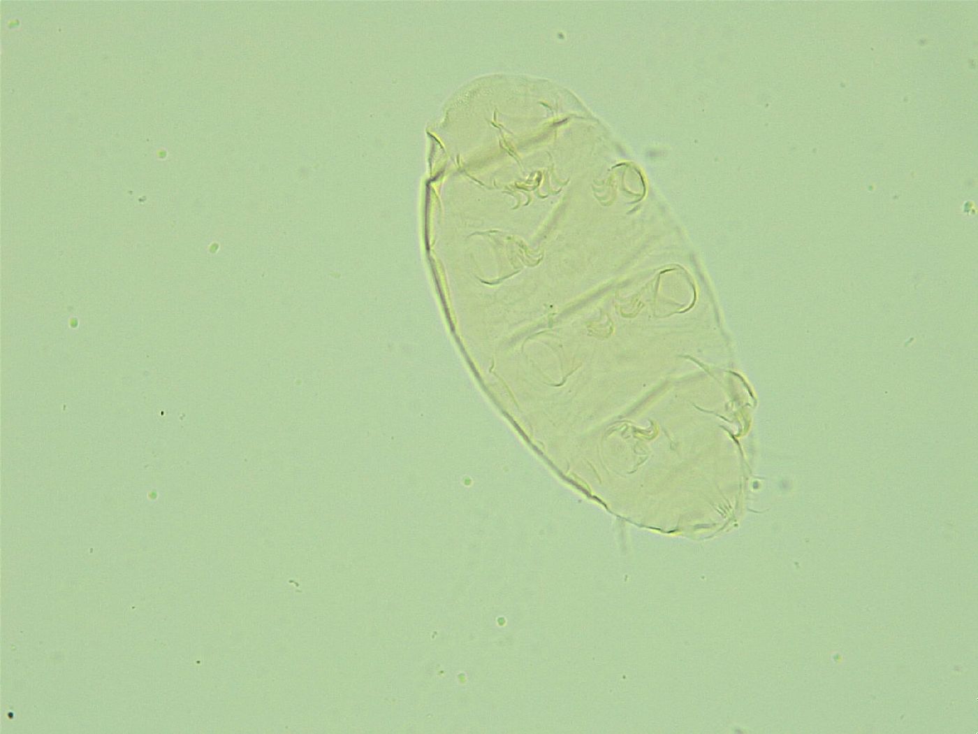 Pseudechiniscus juanitae image