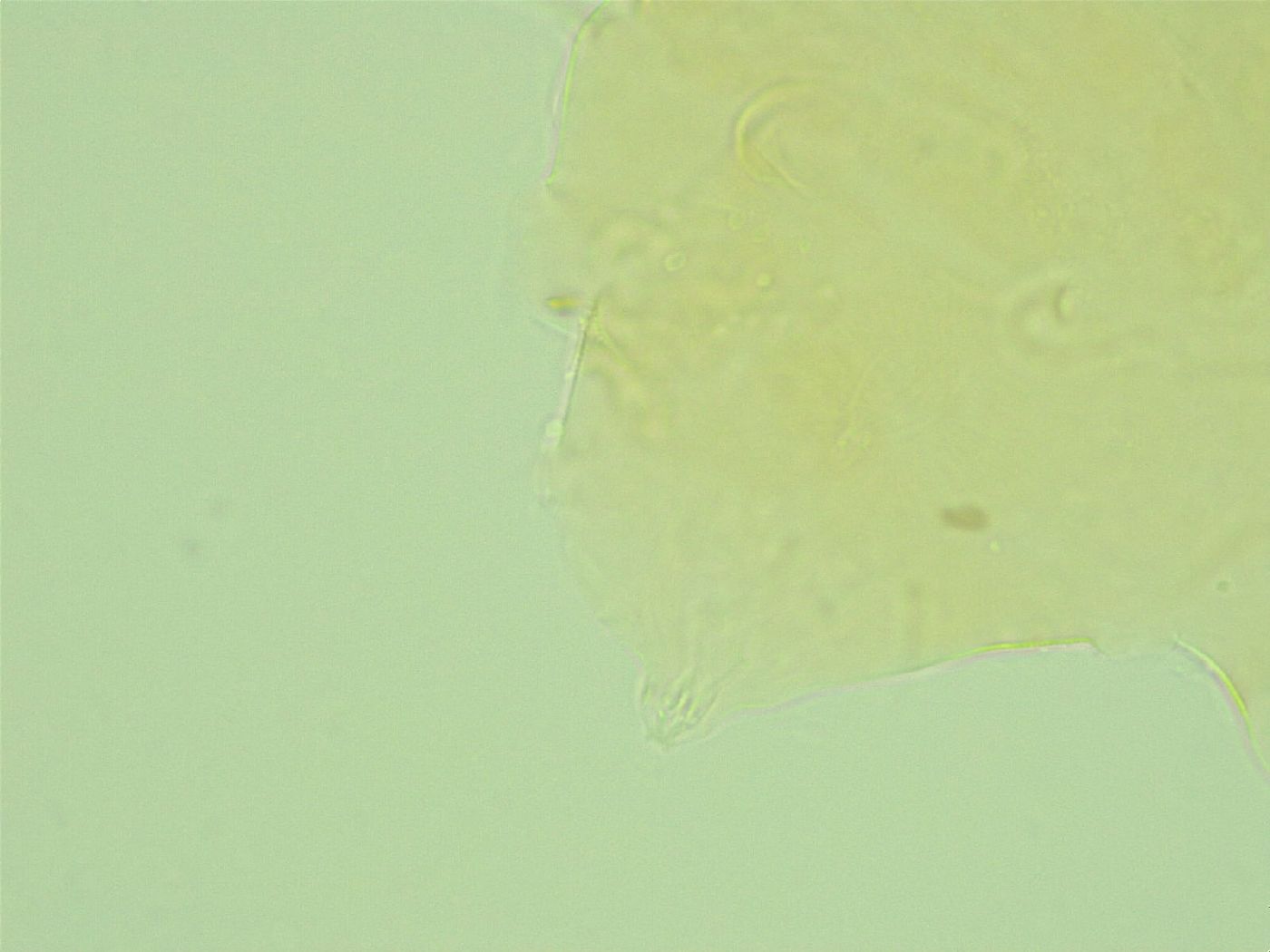 Pseudechiniscus novaezeelandiae image