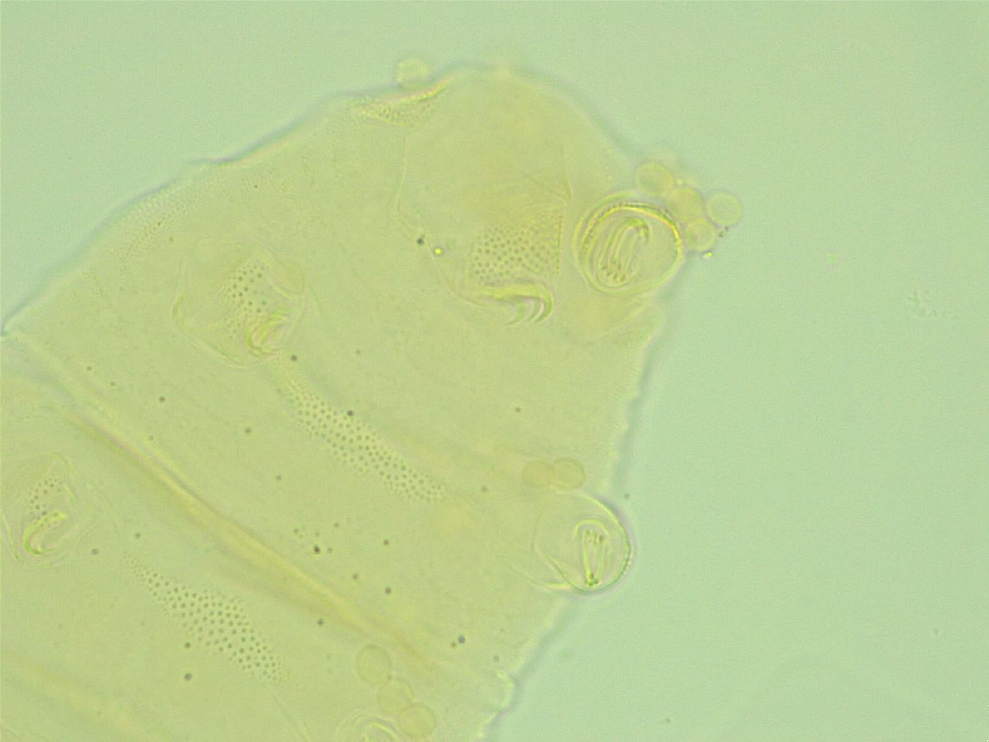 Pseudechiniscus novaezeelandiae image