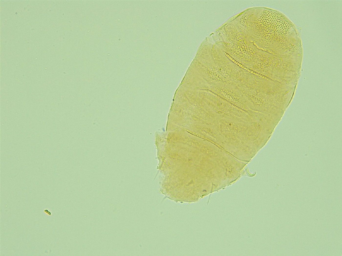 Pseudechiniscus novaezeelandiae image