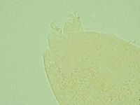 Pseudechiniscus suillus image