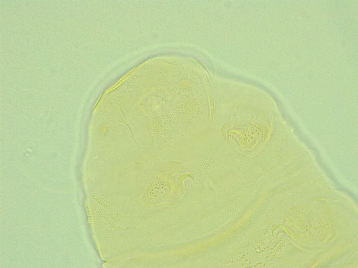 Pseudechiniscus ramazzottii image