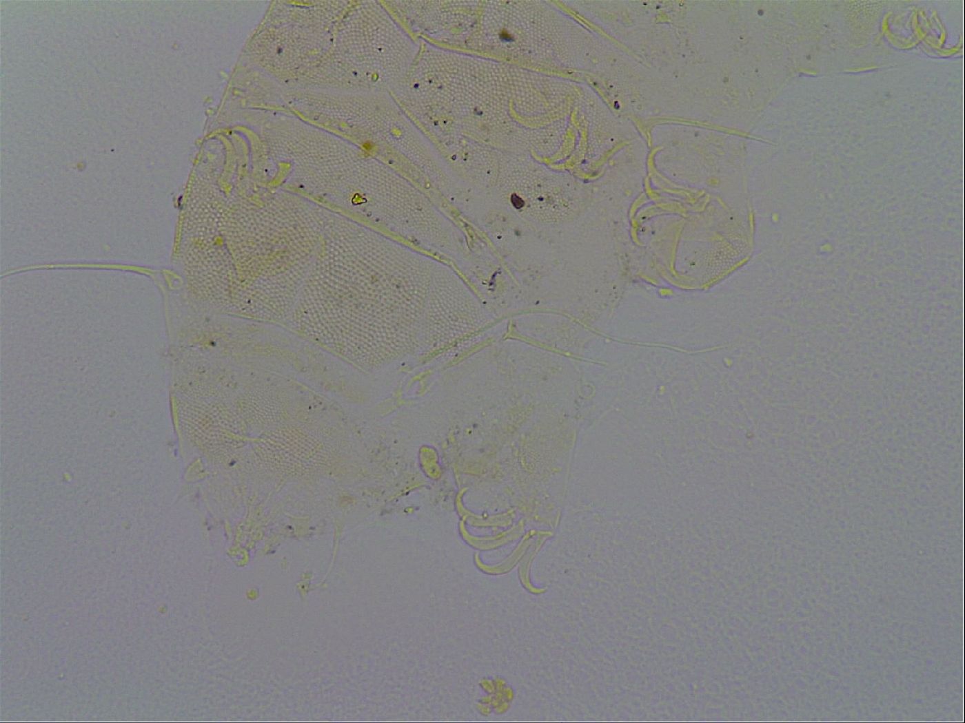 Acanthechiniscus victor image