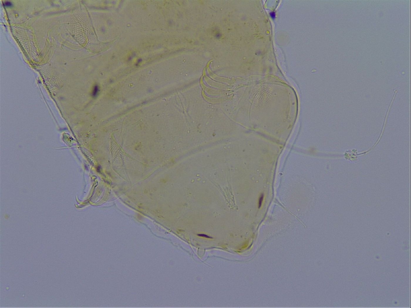 Acanthechiniscus victor image