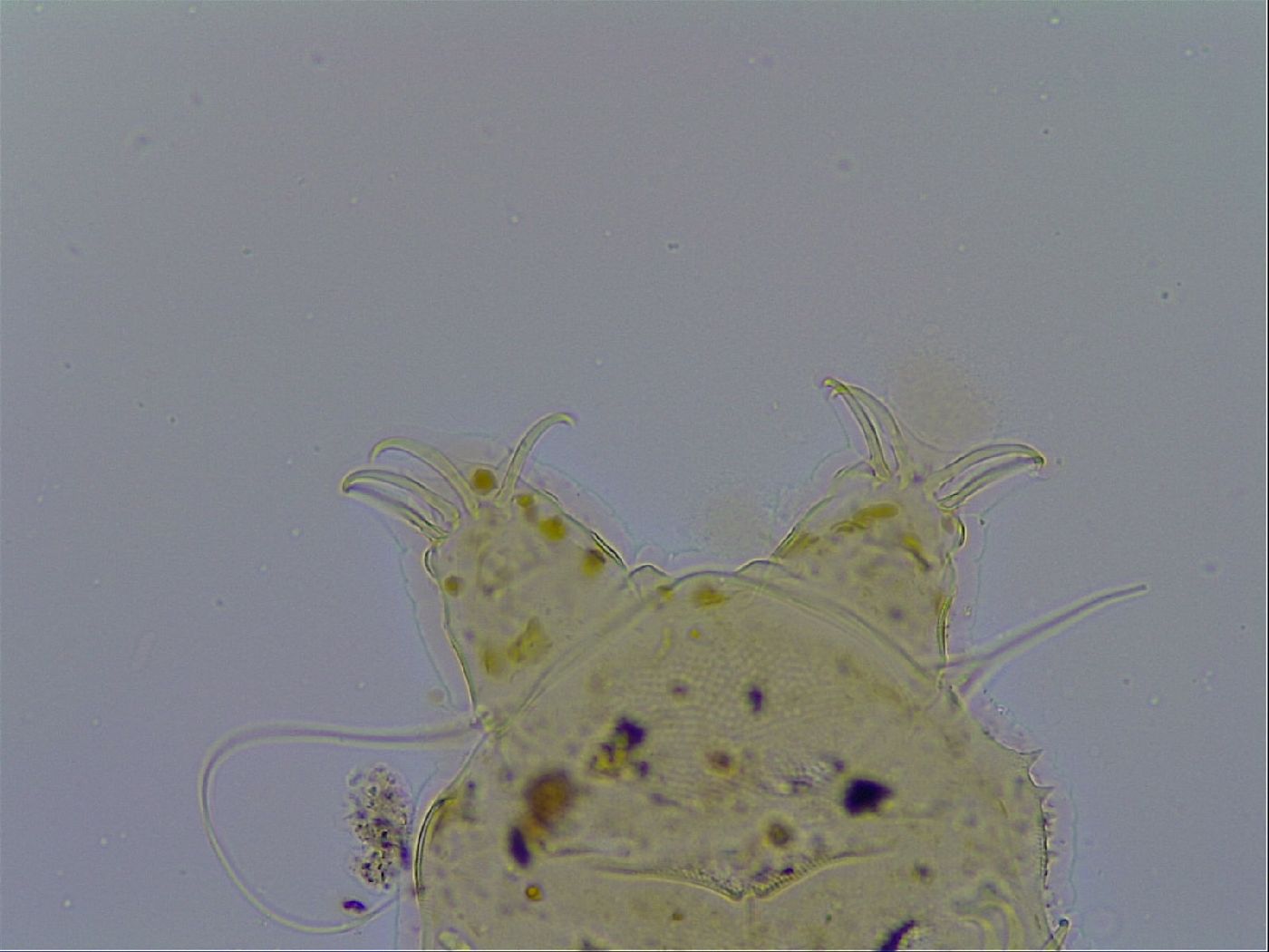Acanthechiniscus victor image