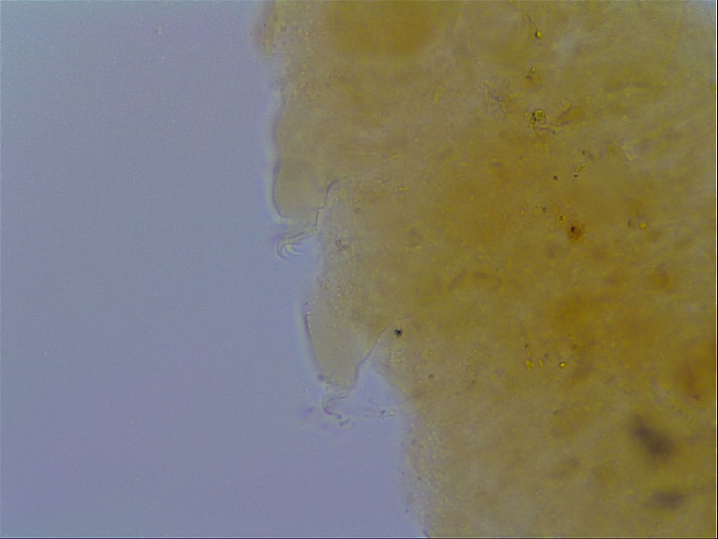 Pseudechiniscus ramazzottii facettalis image