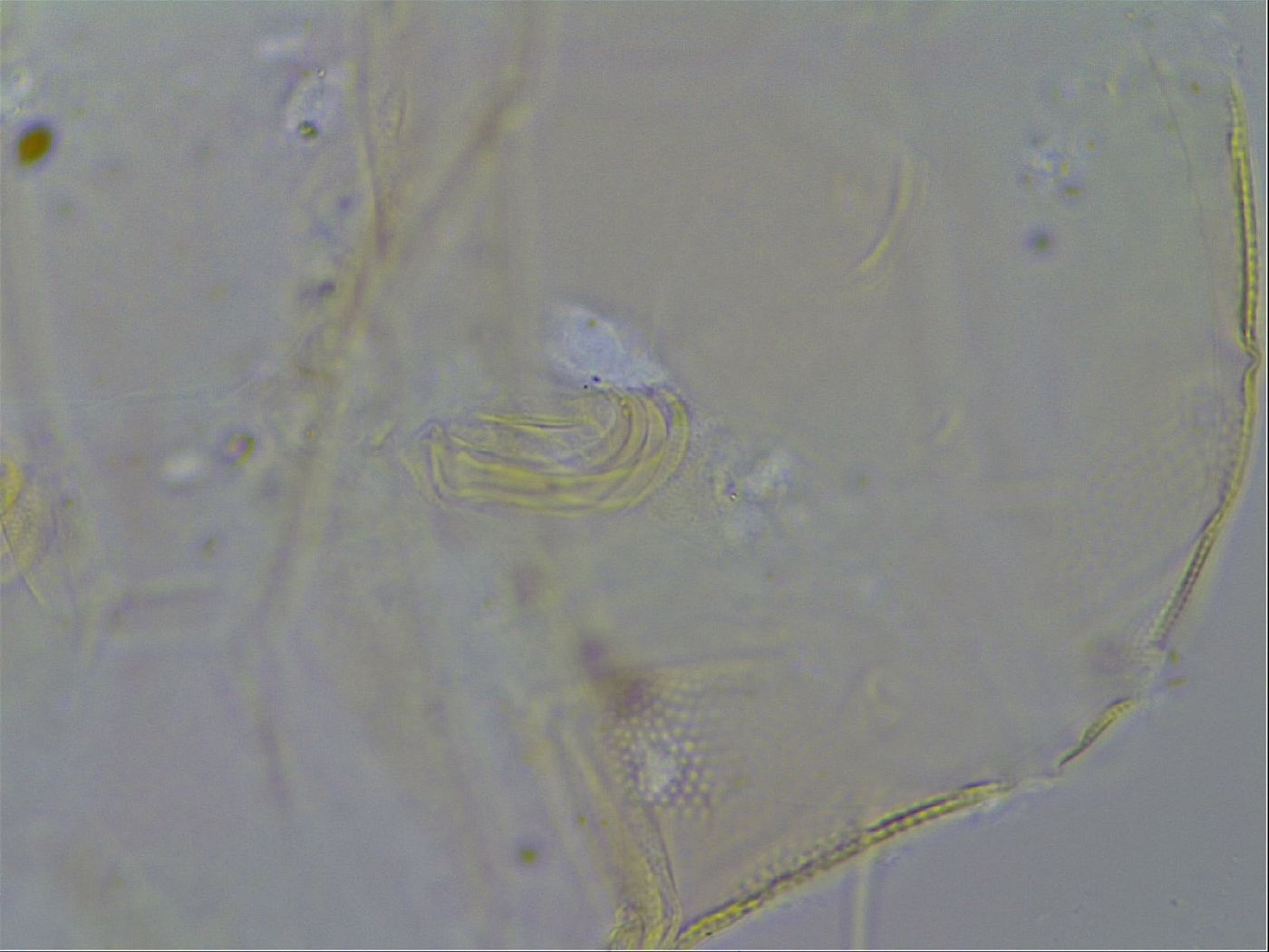 Acanthechiniscus victor image