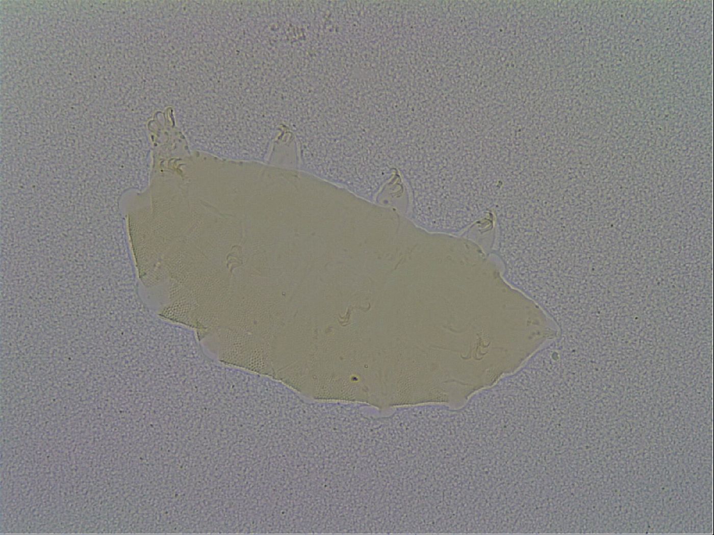 Pseudechiniscus suillus image