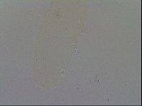 Milnesium tardigradum image