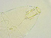 Milnesium tardigradum image