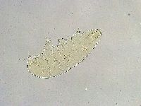 Milnesium tardigradum image