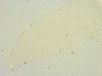 Milnesium tardigradum image