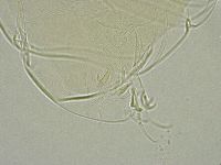 Image of Milnesium tardigradum