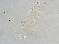 Milnesium tardigradum image