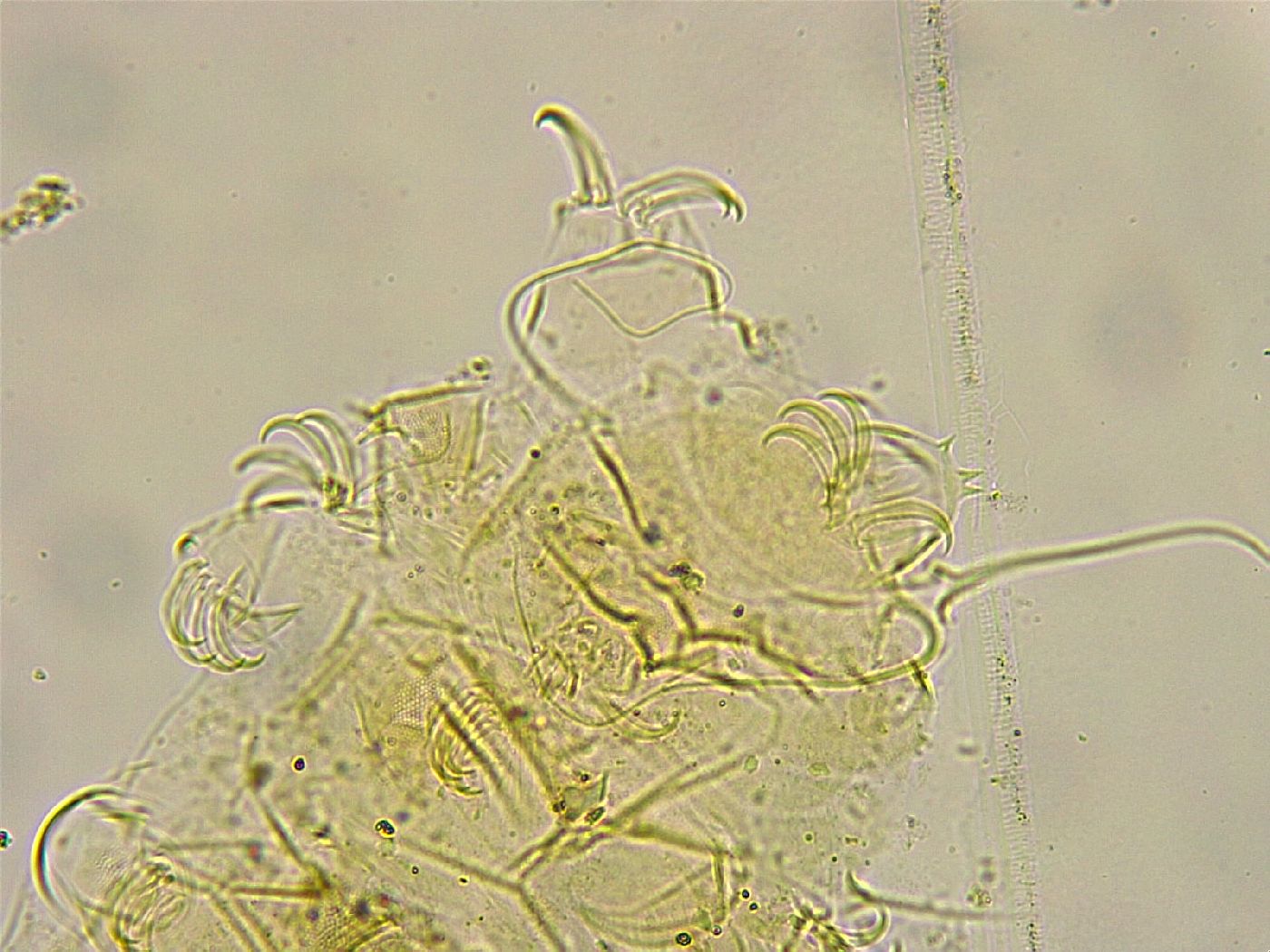 Acanthechiniscus victor image