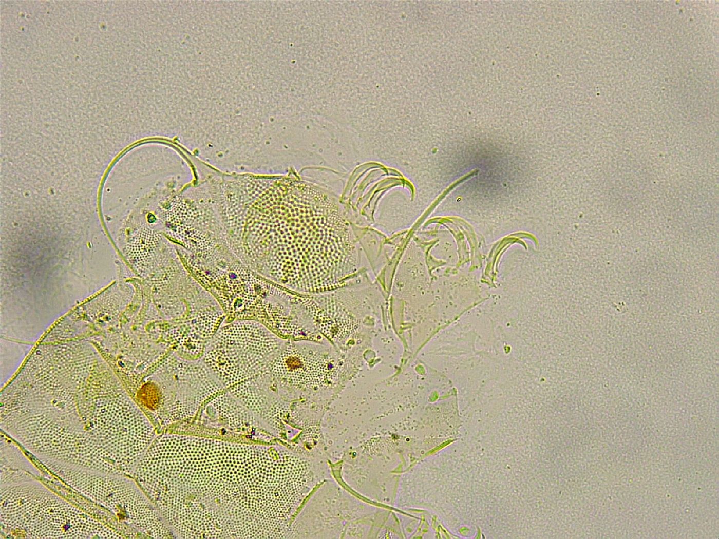 Acanthechiniscus victor image