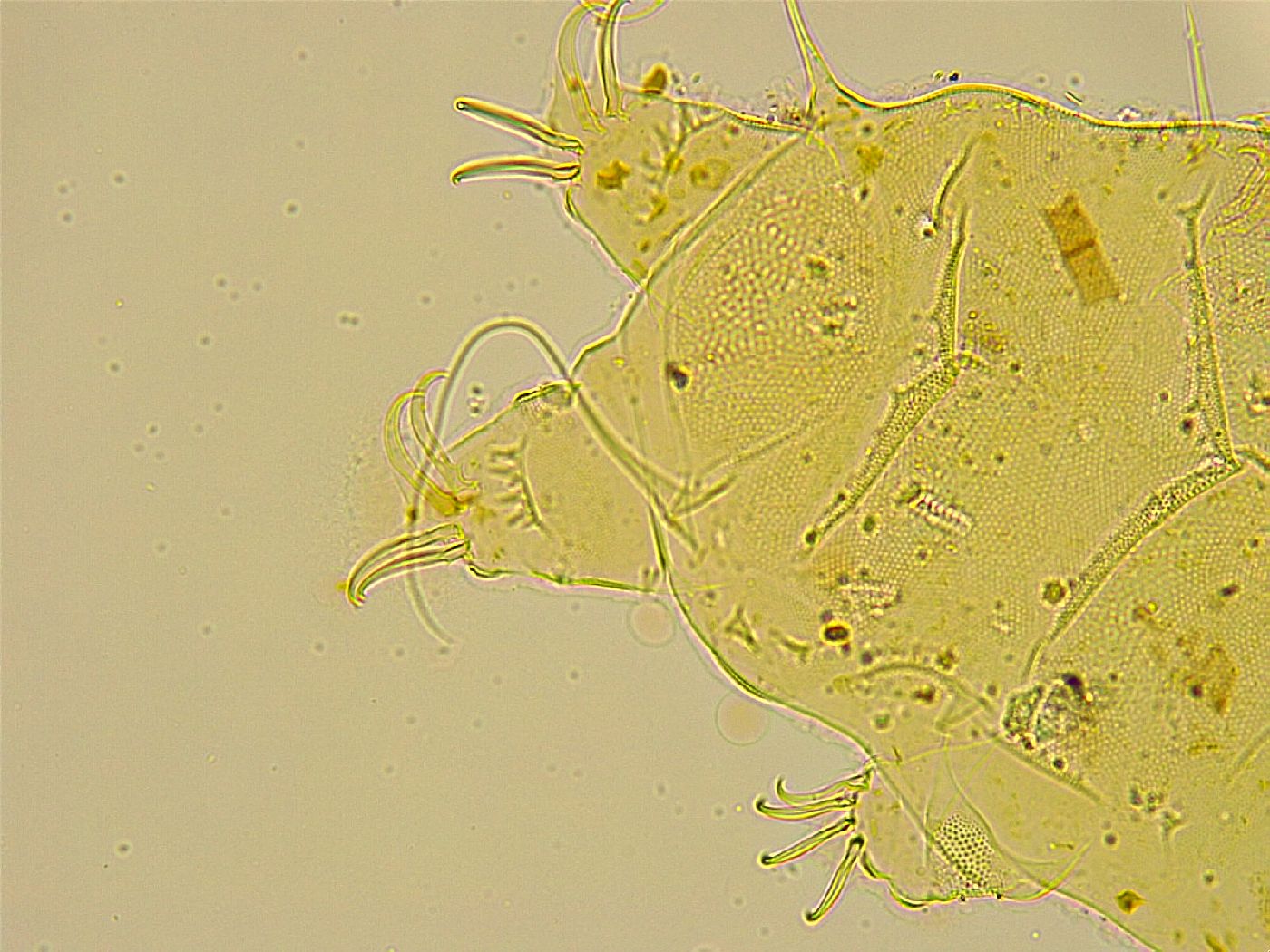 Acanthechiniscus victor image