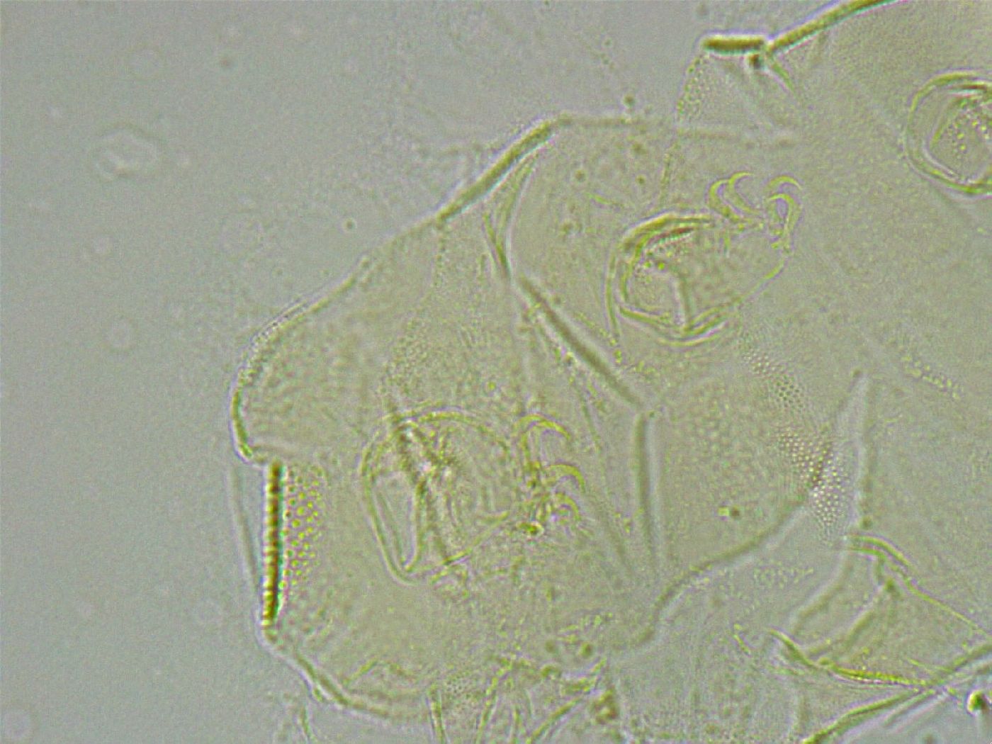 Pseudechiniscus ramazzottii facettalis image