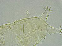 Pseudechiniscus ramazzottii image