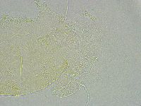 Pseudechiniscus ramazzottii image