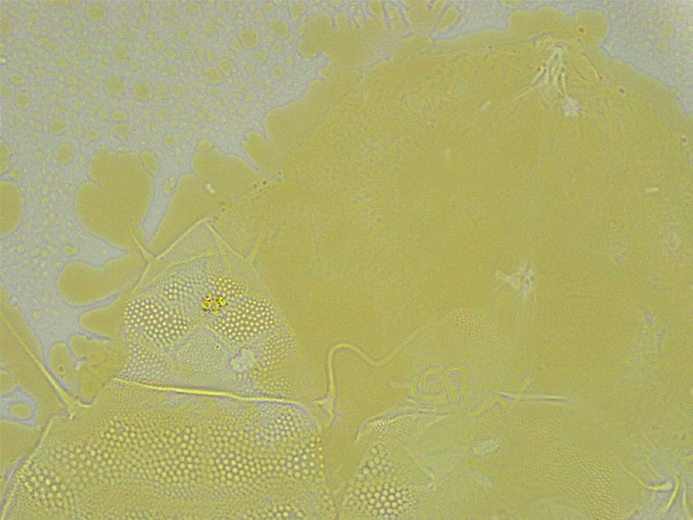 Pseudechiniscus ramazzottii facettalis image