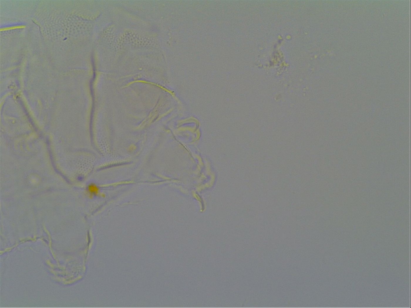 Pseudechiniscus suillus image