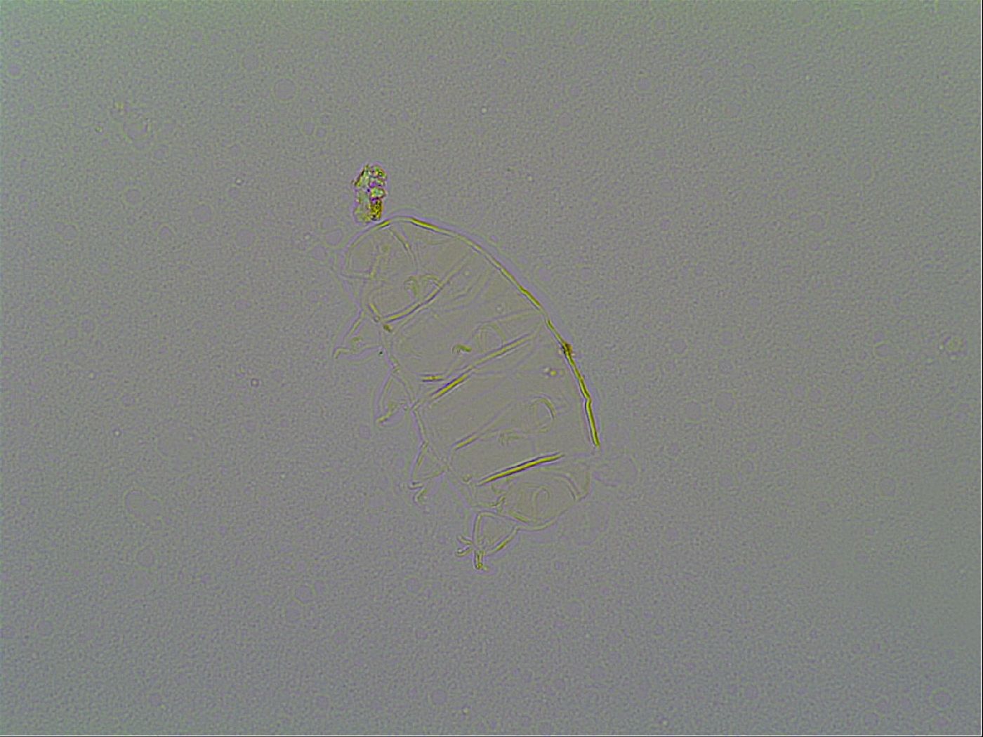 Pseudechiniscus suillus image